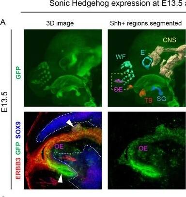Detection of ErbB3/Her3 by Immunohistochemistry