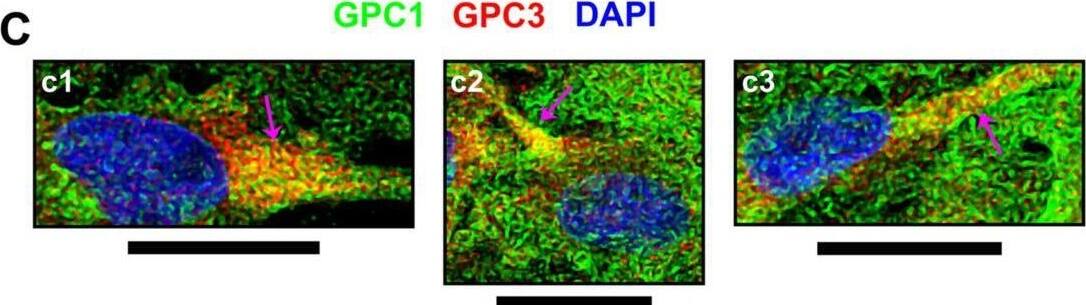 Detection of Glypican 1 by Immunocytochemistry/ Immunofluorescence