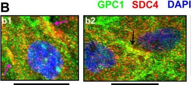 Detection of Glypican 1 by Immunocytochemistry/ Immunofluorescence