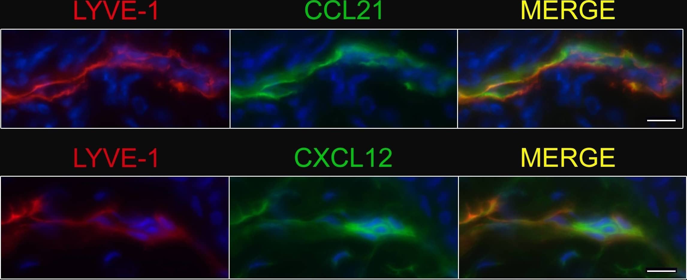 Detection of Mouse CCL21/6Ckine by Immunohistochemistry