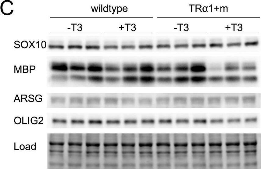 Detection of Mouse Arylsulfatase G/ARSG by Western Blot