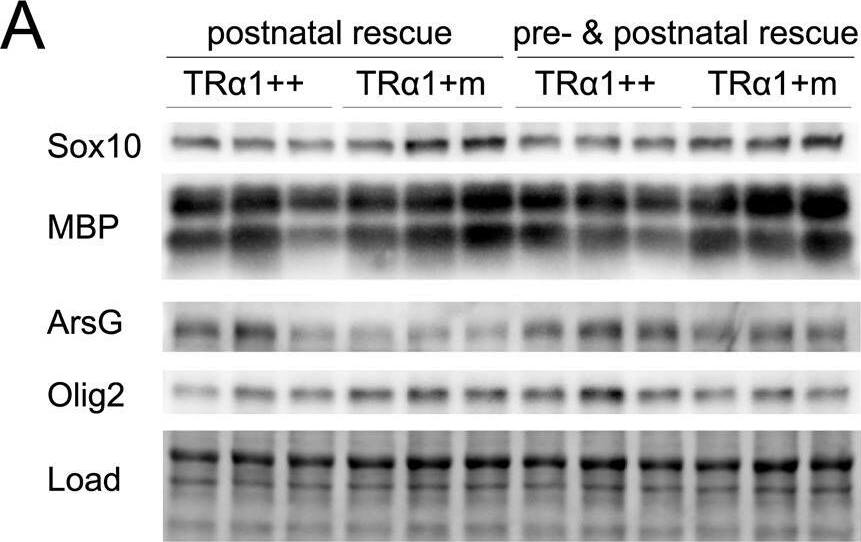 Detection of Mouse Arylsulfatase G/ARSG by Western Blot