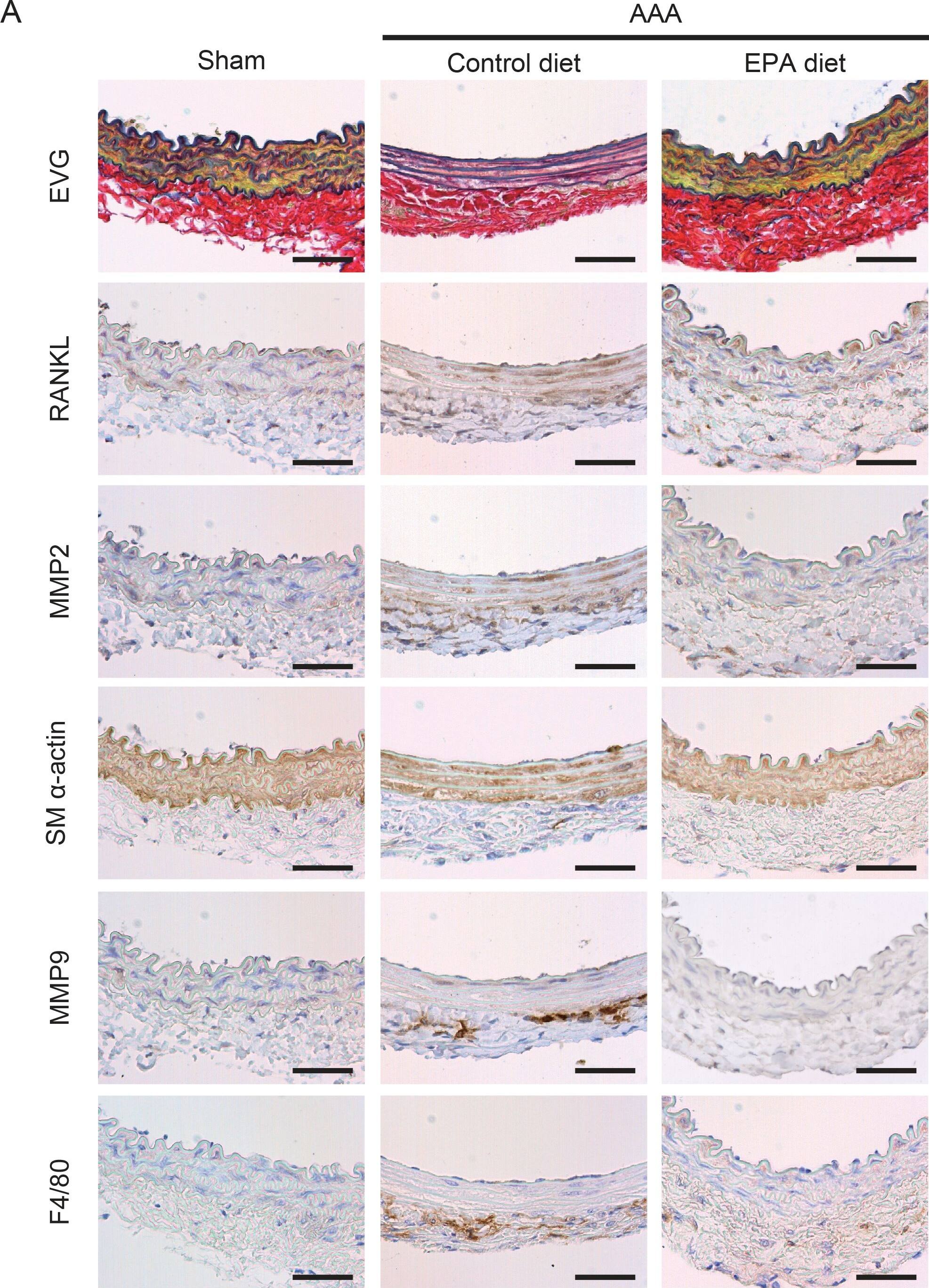 Detection of Mouse TRANCE/TNFSF11/RANK L by Immunohistochemistry-Paraffin