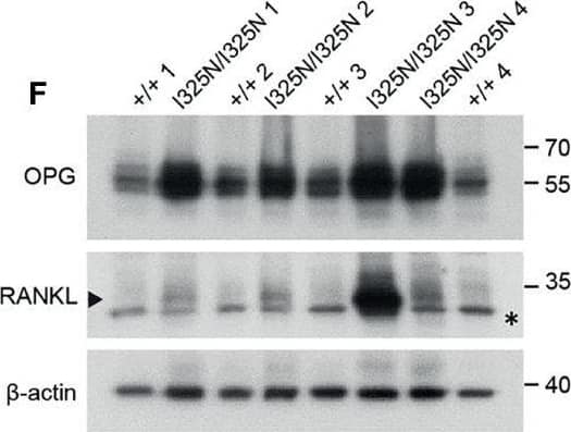 Detection of TRANCE/TNFSF11/RANK L by Western Blot