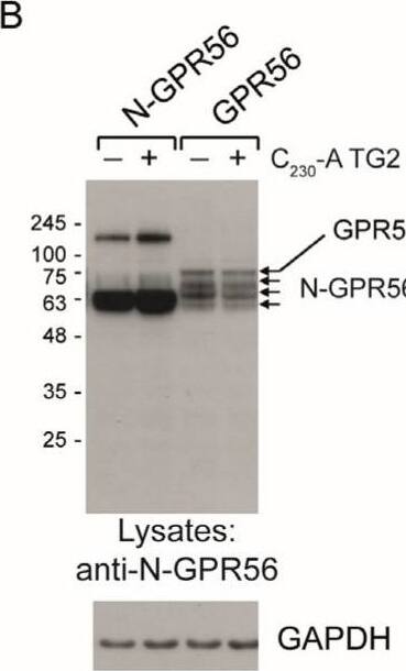 Detection of GPR56 by Western Blot