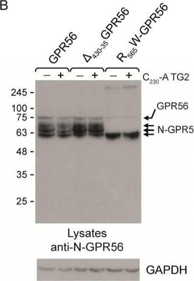 Detection of GPR56 by Western Blot