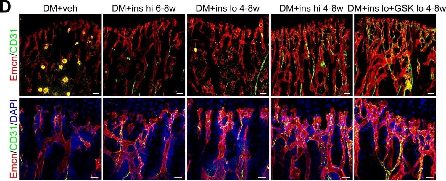 Detection of Mouse Endomucin/Mucin -14 by Immunocytochemistry/Immunofluorescence