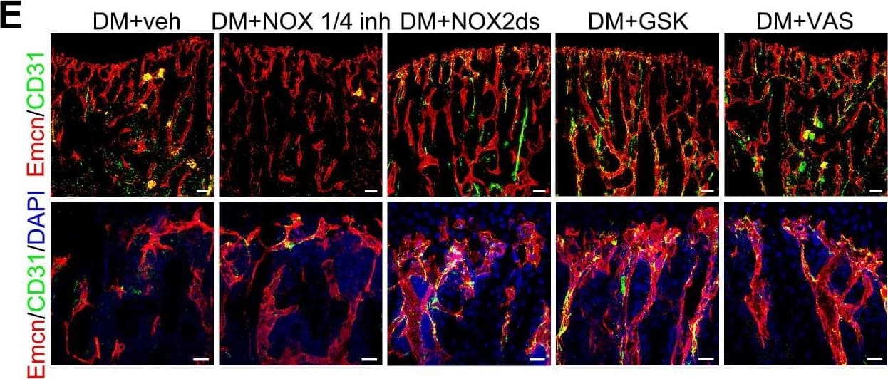 Detection of Mouse Endomucin/Mucin -14 by Immunocytochemistry/Immunofluorescence