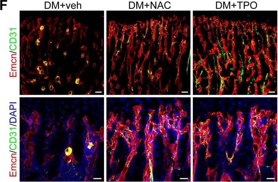 Detection of Mouse Endomucin/Mucin -14 by Immunocytochemistry/Immunofluorescence