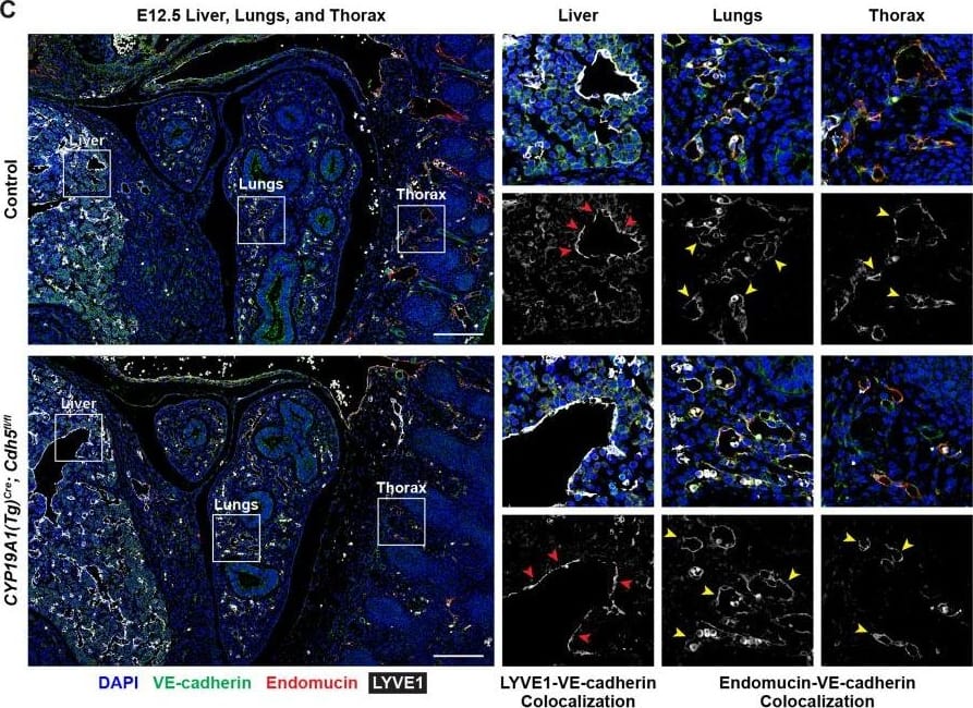 Detection of Mouse Endomucin/Mucin -14 by Immunohistochemistry