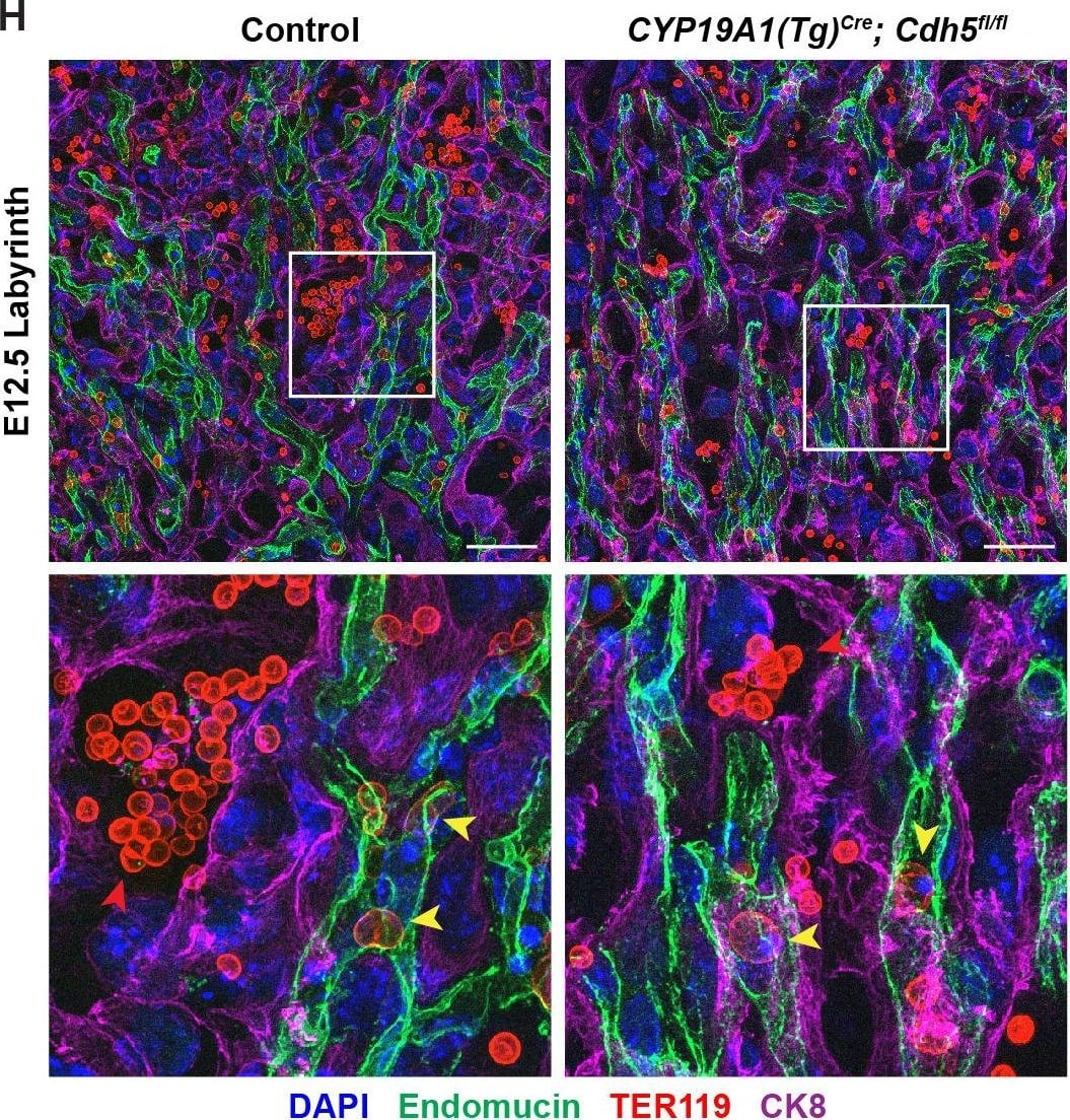 Detection of Mouse Endomucin/Mucin -14 by Immunohistochemistry