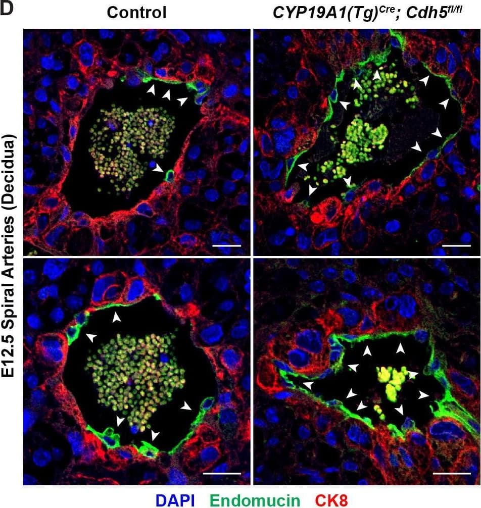 Detection of Mouse Endomucin/Mucin -14 by Immunohistochemistry
