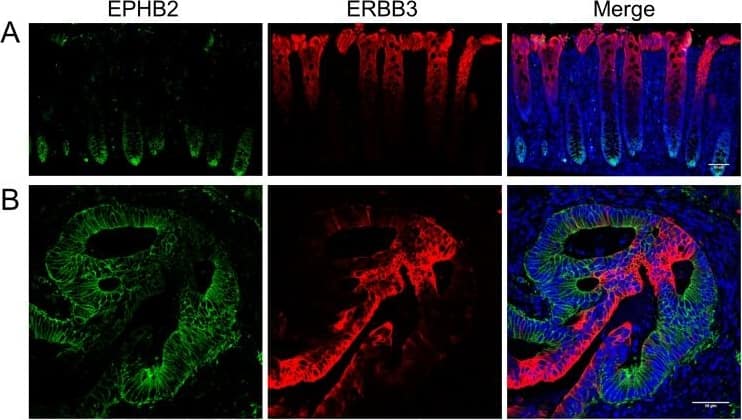 Detection of Human EphB2 by Immunocytochemistry/Immunofluorescence