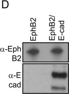 Detection of Human EphB2 by Western Blot