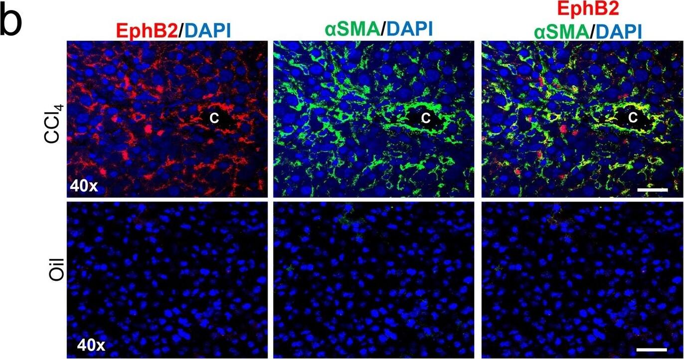 Detection of Mouse EphB2 by Immunocytochemistry/Immunofluorescence