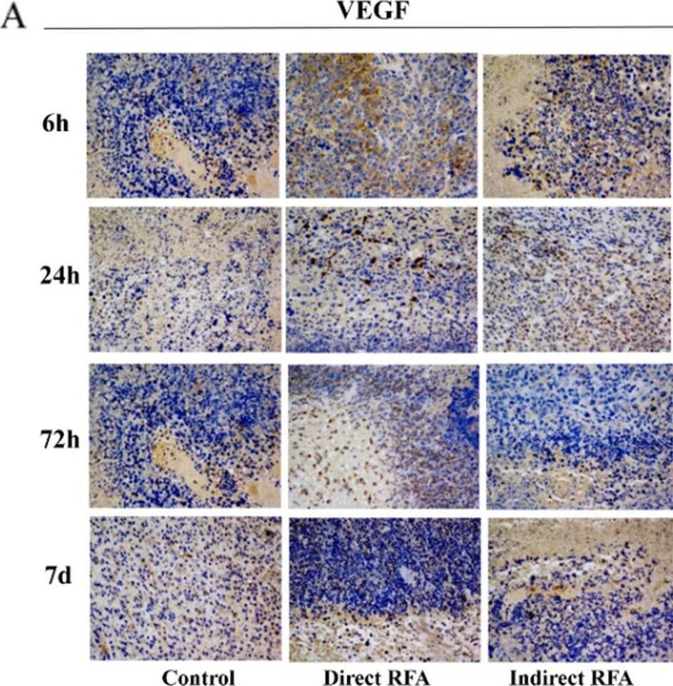 Detection of Mouse VEGF-D by Immunohistochemistry