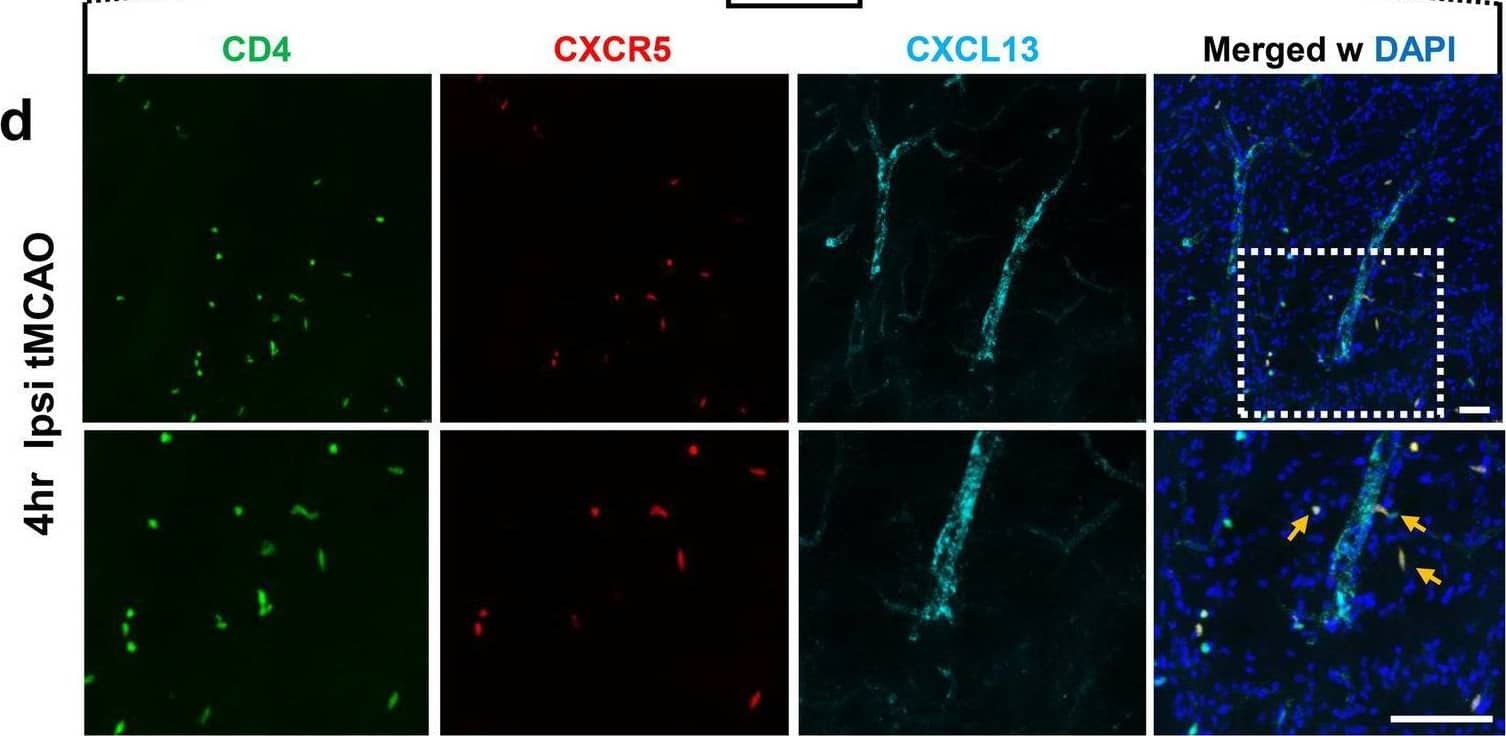 Detection of Mouse CXCL13/BLC/BCA-1 by Immunohistochemistry