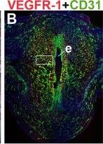 Detection of Mouse Mouse VEGFR1/Flt-1 Antibody by Immunohistochemistry