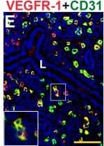 Detection of Mouse Mouse VEGFR1/Flt-1 Antibody by Immunohistochemistry