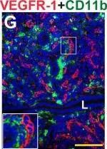 Detection of Mouse Mouse VEGFR1/Flt-1 Antibody by Immunohistochemistry
