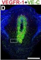Detection of Mouse Mouse VEGFR1/Flt-1 Antibody by Immunohistochemistry