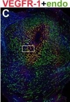 Detection of Mouse Mouse VEGFR1/Flt-1 Antibody by Immunohistochemistry
