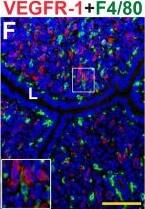 Detection of Mouse Mouse VEGFR1/Flt-1 Antibody by Immunohistochemistry