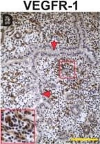 Detection of Mouse Mouse VEGFR1/Flt-1 Antibody by Immunohistochemistry