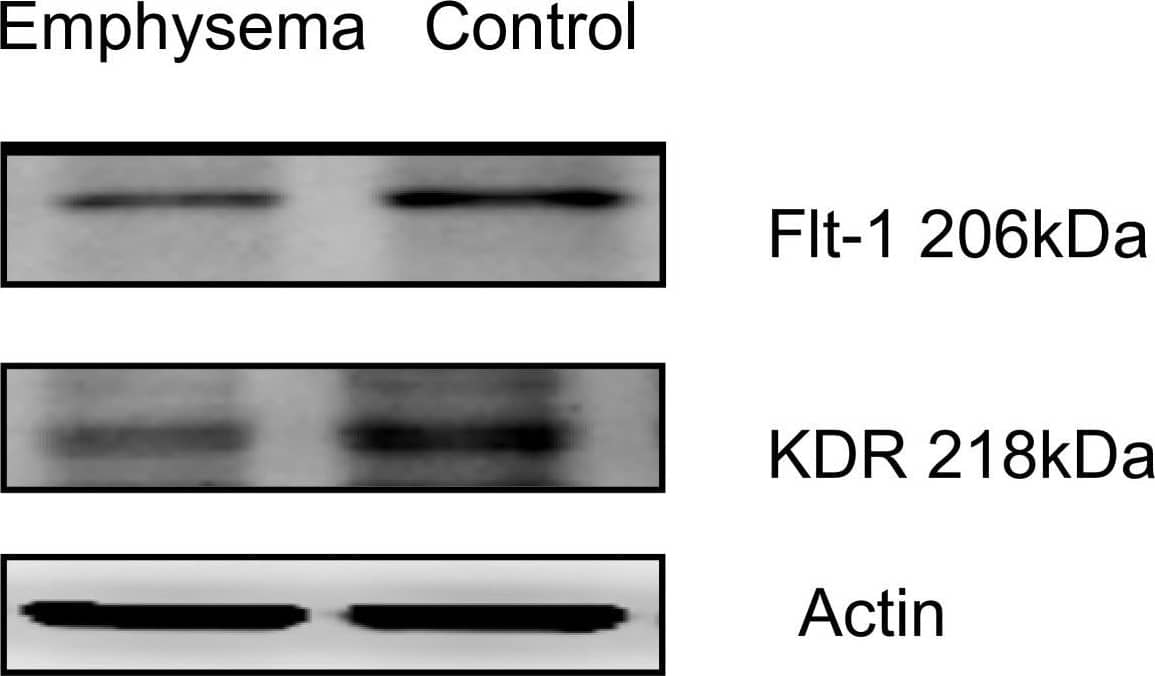 Detection of Mouse VEGFR1/Flt-1 by Western Blot