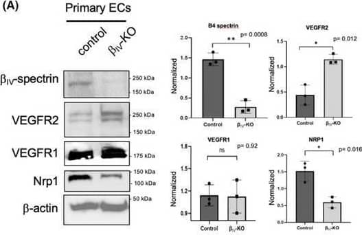 Detection of Mouse VEGFR1/Flt-1 by Western Blot