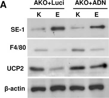 Detection of UCP2 by Western Blot