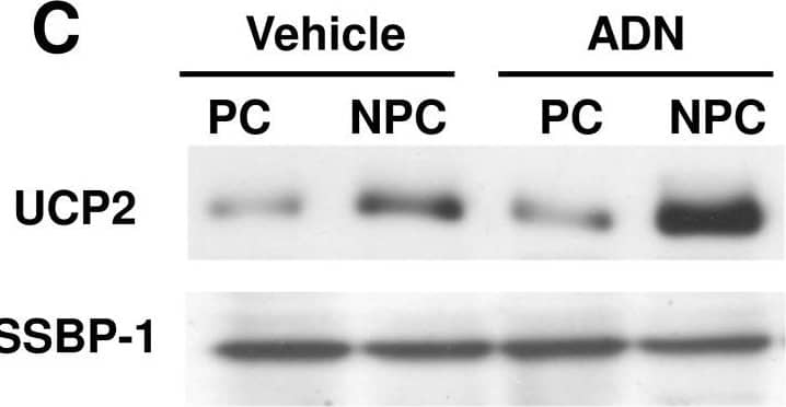 Detection of UCP2 by Western Blot