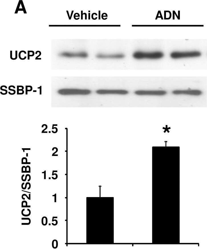 Detection of UCP2 by Western Blot