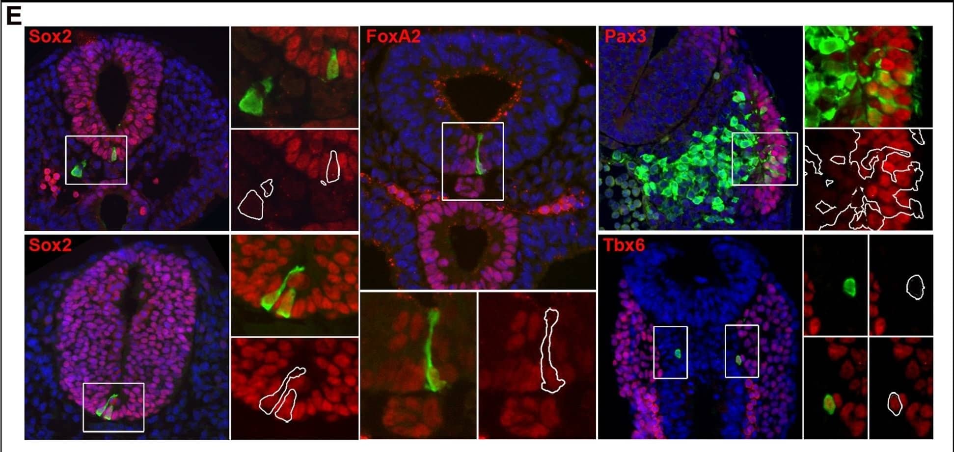 Detection of Mouse TBX6 by Immunocytochemistry/ Immunofluorescence