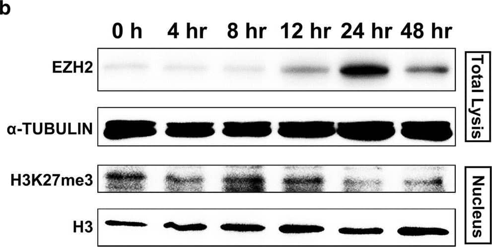 Detection of Human EZH2/KMT6 by Western Blot