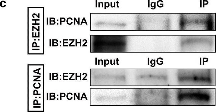 Detection of Human EZH2/KMT6 by Proximity Ligation Assay