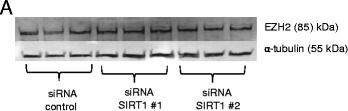 Detection of Human EZH2/KMT6 by Western Blot