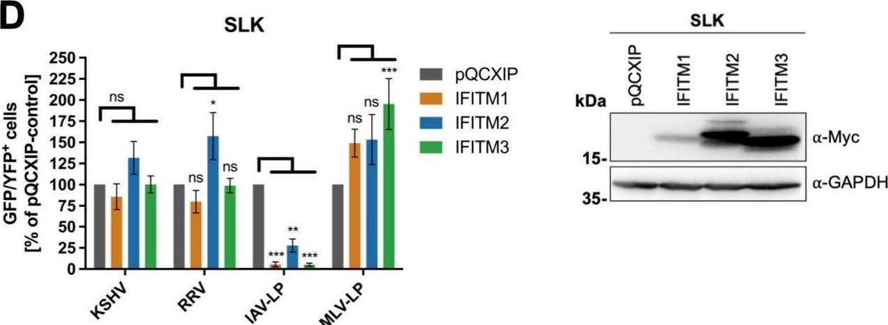 Detection of IFITM1 by Western Blot