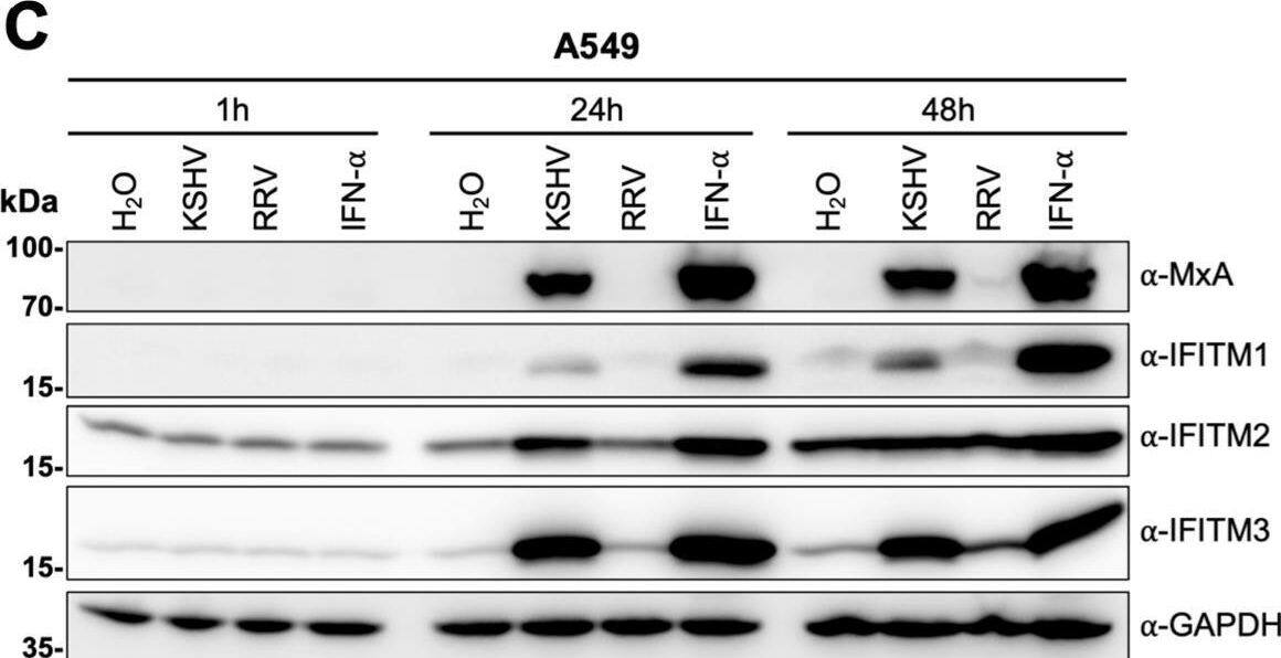 Detection of IFITM1 by Western Blot