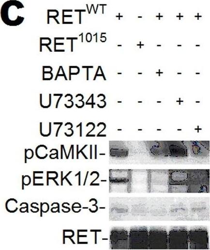 Detection of Mouse Ret by Western Blot