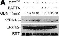 Detection of Mouse Ret by Western Blot