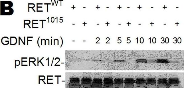 Detection of Mouse Ret by Western Blot
