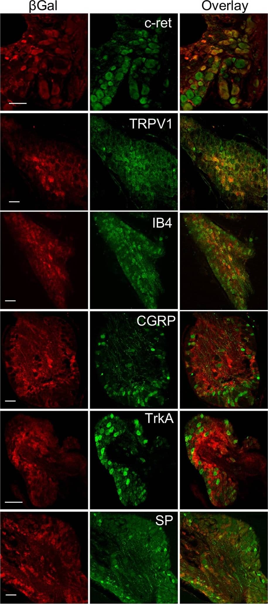 Detection of Mouse Ret by Immunohistochemistry