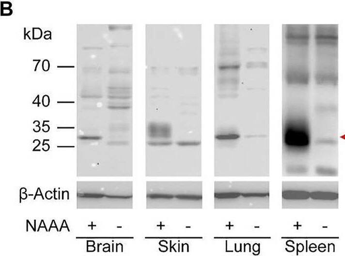 Detection of ASAHL/N-acylethanolamine-hydrolyzing Acid A by Western Blot