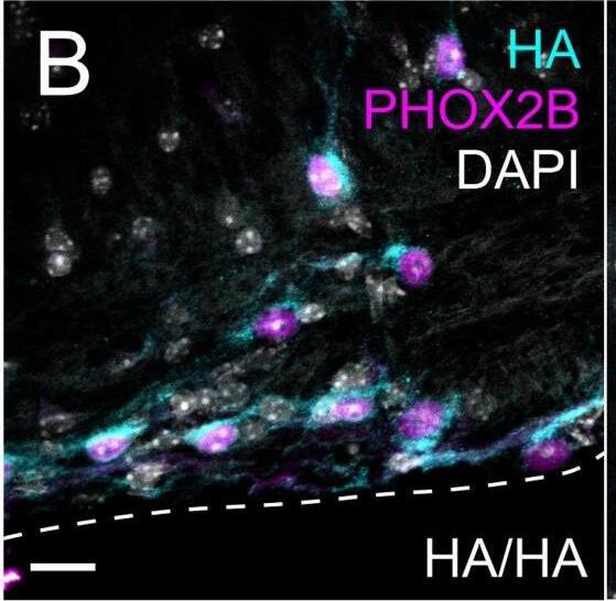 Detection of PHOX2B by Immunohistochemistry