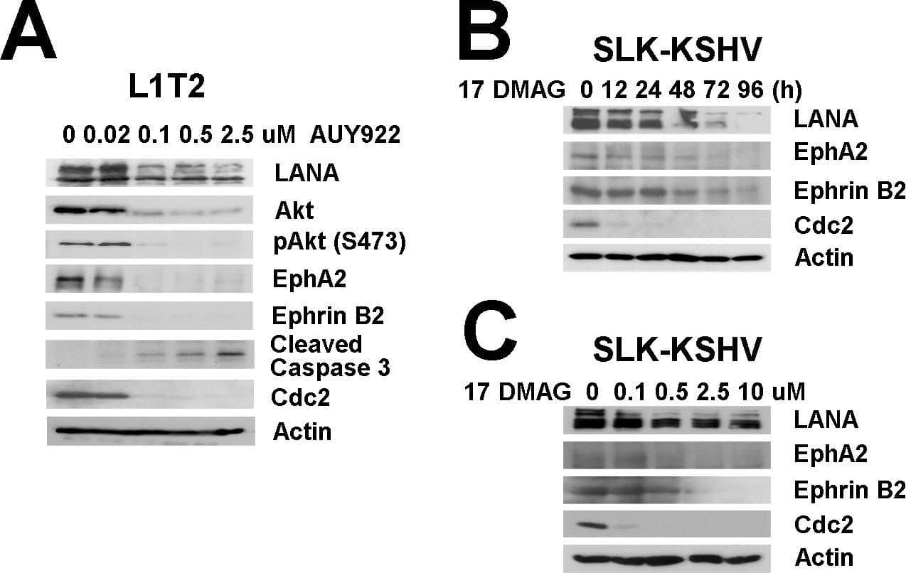 Detection of Ephrin-B2 by Western Blot