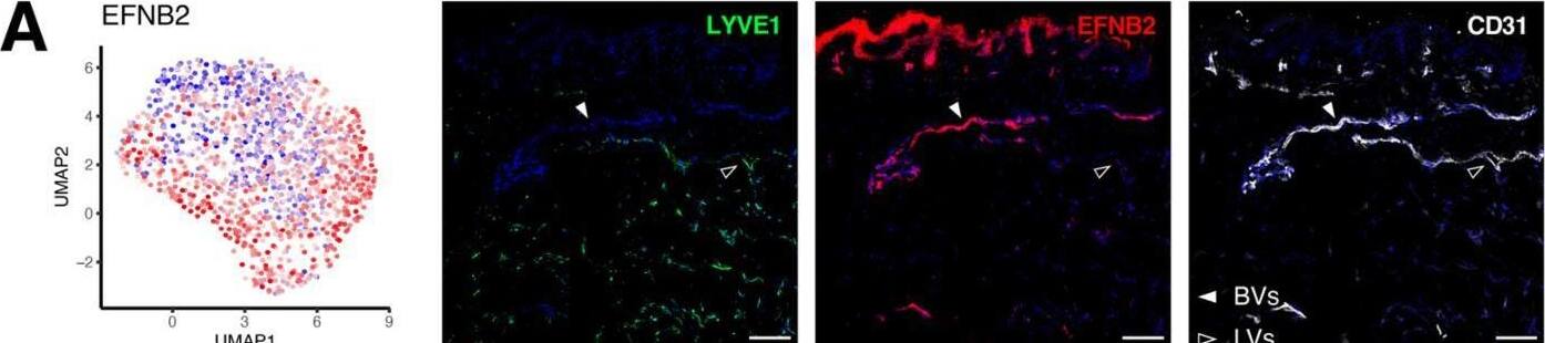 Detection of Human Ephrin-B2 by Immunohistochemistry