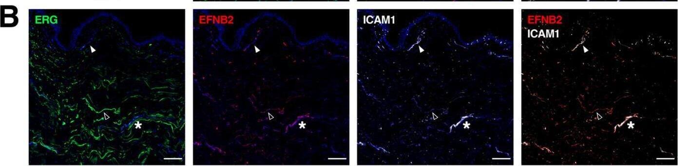 Detection of Human Ephrin-B2 by Immunohistochemistry