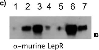 Detection of Human Leptin R by Western Blot