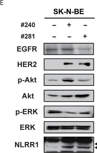 Detection of LRRN1/NLRR-1 by Western Blot